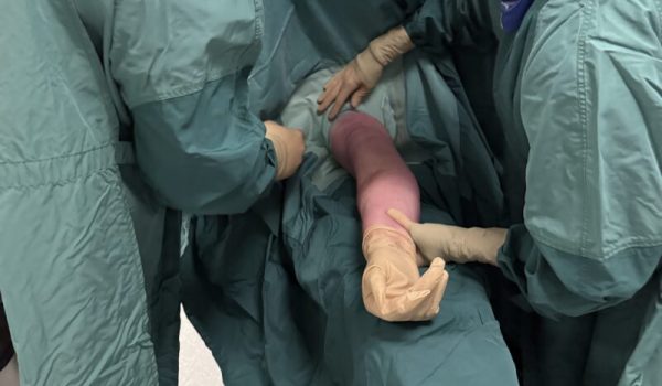 voorbereiding-plaatsing-armpoort-aspect-ratio-800-500